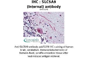 Image no. 1 for anti-Solute Carrier Family 5 (Sodium/glucose Cotransporter), Member 9 (SLC5A9) (Internal Region) antibody (ABIN1739410) (SLC5A9 抗体  (Internal Region))