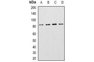 Western blot analysis of KCNN3 expression in Raji (A), mouse heart (B), mouse livere (C), rat brain (D) whole cell lysates. (KCNN3 抗体)