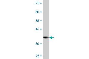 Western Blot detection against Immunogen (35. (Recoverin 抗体  (AA 91-181))