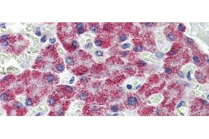 Immunohistochemistry (IHC) image for anti-Acetyl-CoA Acyltransferase 1 (ACAA1) (N-Term) antibody (ABIN2783261)