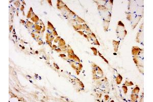 Paraformaldehyde-fixed, paraffin embedded human muscle tissue, Antigen retrieval by boiling in sodium citrate buffer (pH6) for 15min, Block endogenous peroxidase by 3% hydrogen peroxide for 30 minutes, Blocking buffer (normal goat serum) at 37°C for 20min, Antibody incubation with TXLNB Polyclonal Antibody, Unconjugated  at 1:500 overnight at 4°C, followed by a conjugated secondary and DAB staining. (Taxilin beta 抗体  (AA 331-430))