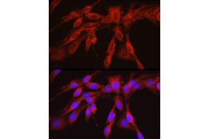 Immunofluorescence analysis of PC-12 cells using PHGDH Rabbit pAb (ABIN6132486, ABIN6145554, ABIN6145555 and ABIN6214726) at dilution of 1:300 (40x lens).