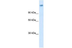 Western Blotting (WB) image for anti-Calcium Channel, Voltage-Dependent, alpha 2/delta Subunit 1 (CACNA2D1) (Middle Region) antibody (ABIN633675)