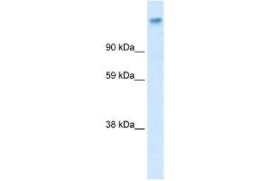 CACNA2D1 antibody used at 0. (CACNA2D1 抗体  (Middle Region))