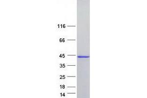 Western Blotting (WB) image for Poly(rC) Binding Protein 2 (PCBP2) (Transcript Variant 3) protein (Myc-DYKDDDDK Tag) (ABIN2728354)