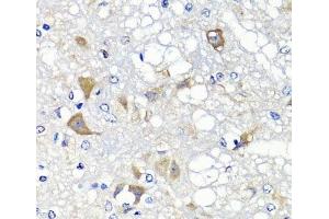 Immunohistochemistry of paraffin-embedded Rat brain using PSPH Polyclonal Antibody at dilution of 1:100 (40x lens). (PSPH 抗体)