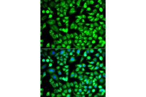 Immunofluorescence analysis of A549 cells using ALKBH4 antibody. (ALKBH4 抗体)