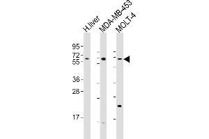 All lanes : Anti-OPN-a/b Antibody (N-term) at 1:1000 dilution Lane 1: human liver lysates Lane 2: MDA-MB-453 whole cell lysates Lane 3: MOLT-4 whole cell lysates Lysates/proteins at 20 μg per lane. (OPN-A,b (AA 14-40), (N-Term) 抗体)