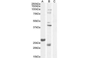 ABIN768639 (1µg/ml) staining of Mouse Testes lysate 1 (A) and Testes lysate 2 (B) + peptide (C) (35µg protein in RIPA buffer). (FGF23 抗体  (Internal Region))
