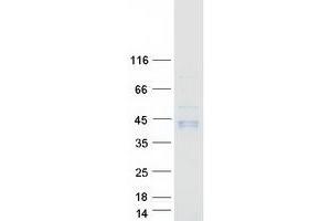Western Blotting (WB) image for gamma-Glutamyl Hydrolase (Conjugase, Folylpolygammaglutamyl Hydrolase) (GGH) protein (Myc-DYKDDDDK Tag) (ABIN2721680)