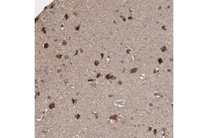 Immunohistochemical staining of human cerebral cortex with ODZ1 polyclonal antibody  shows strong cytoplasmic positivity in neuronal cells at 1:10-1:20 dilution. (ODZ1/Teneurin 1 抗体)