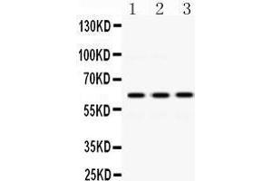 Western Blotting (WB) image for anti-Crossover junction endonuclease EME1 (EME1) (AA 520-561), (C-Term) antibody (ABIN3042370) (Crossover junction endonuclease EME1 (EME1) (AA 520-561), (C-Term) 抗体)
