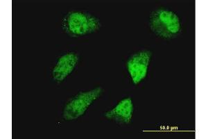 Immunofluorescence of monoclonal antibody to HOXD11 on HeLa cell.