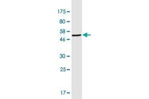 Western Blot detection against Immunogen (49. (CRYbB2 抗体  (AA 1-205))