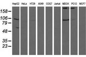 Western blot analysis of extracts (35 µg) from 9 different cell lines by using anti-ALDH1L1 monoclonal antibody. (ALDH1L1 抗体)
