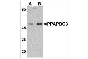 Western Blotting (WB) image for anti-Phosphatidic Acid Phosphatase Type 2 Domain Containing 3 (PPAPDC3) (N-Term) antibody (ABIN783832)