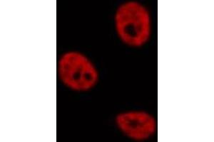 Immunofluorescence (fixed cells) (IF/ICC) image for anti-Polymerase (RNA) II (DNA Directed) Polypeptide E, 25kDa (POLR2E) (Internal Region) antibody (ABIN6264345)