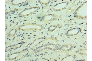 Immunohistochemistry (IHC) image for anti-Transient Receptor Potential Cation Channel, Subfamily V, Member 4 (TRPV4) (AA 1-230) antibody (ABIN7172887)