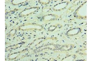Immunohistochemistry of paraffin-embedded human kidney tissue using ABIN7172887 at dilution of 1:100 (TRPV4 抗体  (AA 1-230))