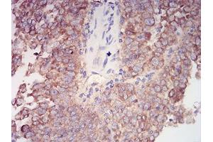 Immunohistochemistry (IHC) image for anti-V-Akt Murine Thymoma Viral Oncogene Homolog 1 (AKT1) (AA 1-150) antibody (ABIN5542264)