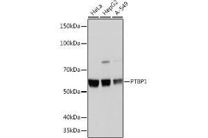 Western blot analysis of extracts of various cell lines, using PTBP1 Rabbit mAb (ABIN7269464) at 1:1000 dilution. (PTBP1 抗体)