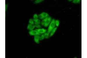 Detection of HSPA1L in Hela cells using Polyclonal Antibody to Heat Shock 70 kDa Protein 1 Like Protein (HSPA1L) (HSPA1L 抗体  (AA 1-641))