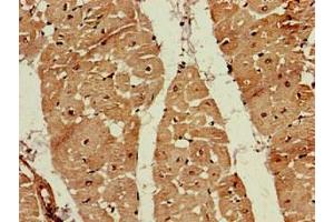 Immunohistochemistry of paraffin-embedded human heart tissue using ABIN7152571 at dilution of 1:100 (FDPS 抗体  (AA 1-419))