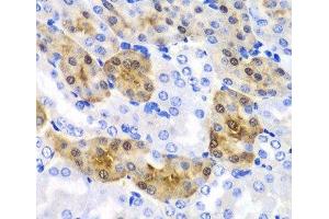 Immunohistochemistry of paraffin-embedded Mouse kidney using HPD Polyclonal Antibody at dilution of 1:100 (40x lens). (HPD 抗体)