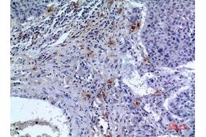 Immunohistochemistry (IHC) analysis of paraffin-embedded Human Lung, antibody was diluted at 1:100. (IREM1 抗体  (Internal Region))
