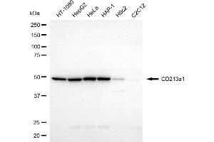 Western blotting analysis using CD213a1 antibody (ABIN7799101).