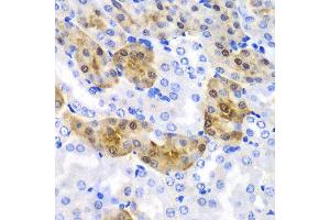 Immunohistochemistry of paraffin-embedded mouse kidney using HPD antibody at dilution of 1:100 (x40 lens). (HPD 抗体)