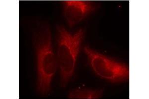 Image no. 3 for anti-14-3-3 zeta (YWHAZ) (pSer58) antibody (ABIN196916) (14-3-3 zeta 抗体  (pSer58))