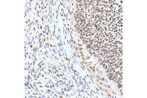 Immunohistochemistry of paraffin-embedded rat ovary using Nucleolin Rabbit mAb (ABIN7269035) at dilution of 1:25 (40x lens). (Nucleolin 抗体)