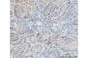 IHC analysis of FEN1 using anti-FEN1 antibody (ABIN7601619).