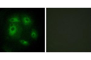 Peptide - +Immunohistochemistry analysis of paraffin-embedded human prostate carcinoma tissue, using DLEC1 antibody. (DLEC1 抗体)