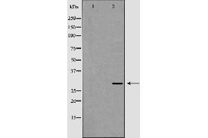 Western blot analysis of XBP1 expression in HepG2 cell lysate,The lane on the left is treated with the antigen-specific peptide. (XBP1 抗体  (C-Term))