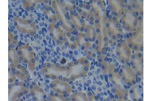 IHC-P analysis of Mouse Kidney Tissue, with DAB staining. (CYP26A1 抗体  (AA 250-495))