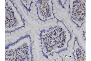 Immunoperoxidase of monoclonal antibody to MPHOSPH9 on formalin-fixed paraffin-embedded human small Intestine. (MPHOSPH9 抗体  (AA 922-1031))