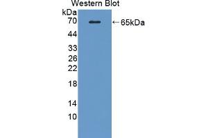 Detection of Recombinant MAOA, Rat using Polyclonal Antibody to Monoamine Oxidase A (MAOA) (Monoamine Oxidase A 抗体  (AA 2-497))