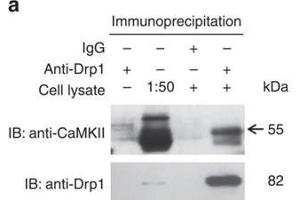Western Blotting (WB) image for anti-Calcium/calmodulin-Dependent Protein Kinase II delta (CAMK2D) antibody (ABIN2856806)