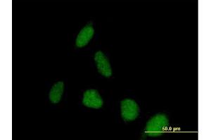 Immunofluorescence of purified MaxPab antibody to PSD on HeLa cell. (PSD 抗体  (AA 1-1024))