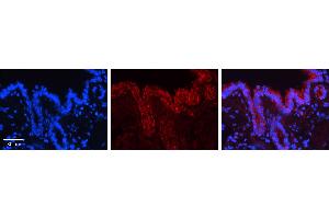 CALR antibody - C-terminal region (ARP30114_P050) Catalog Number: ARP30114_P050  Formalin Fixed Paraffin Embedded Tissue: Human Bronchial Epithelial Tissue  Observed Staining: Cytoplasm and membrane of bronchial epithelial tissue Primary Antibody Concentration: 1:100 Secondary Antibody: Donkey anti-Rabbit-Cy3  Secondary Antibody Concentration: 1:200  Magnification: 20X  Exposure Time: 0. (Calreticulin 抗体  (C-Term))