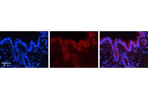 CALR antibody - C-terminal region (ARP30114_P050) Catalog Number: ARP30114_P050  Formalin Fixed Paraffin Embedded Tissue: Human Bronchial Epithelial Tissue  Observed Staining: Cytoplasm and membrane of bronchial epithelial tissue Primary Antibody Concentration: 1:100 Secondary Antibody: Donkey anti-Rabbit-Cy3  Secondary Antibody Concentration: 1:200  Magnification: 20X  Exposure Time: 0. (Calreticulin 抗体  (C-Term))