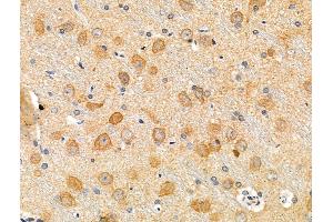 Phospho-alpha 1 Catenin (Ser655/Thr658) Antibody at 1/100 staining Rat brain tissue by IHC-P.