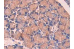 Immunohistochemistry (IHC) image for anti-Spectrin alpha Chain, Brain (SPTAN1) (AA 2071-2269) antibody (ABIN7438451)