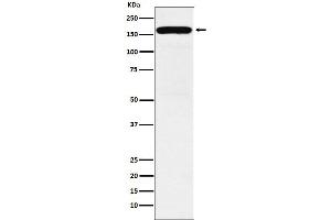 Western blot analysis of DIAPH1 expression in K562 cell lysate. (Recombinant DIAPH1 抗体)