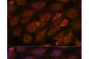 Immunofluorescence analysis of C6 cells using CREB3 Polyclonal Antibody at dilution of 1:100. (CREB3 抗体)