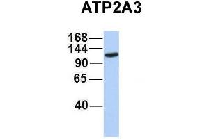 Host:  Rabbit  Target Name:  ATP2A3  Sample Type:  MCF7  Antibody Dilution:  1. (ATP2A3 抗体  (Middle Region))