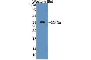 Western blot analysis of the recombinant protein. (PDK3 抗体  (AA 138-396))