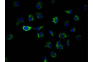 Immunofluorescence staining of MCF7 Cells with ABIN7127572 at 1:50, counter-stained with DAPI. (Recombinant ILK 抗体)
